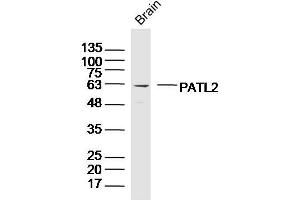 Mouse brain lysates probed with PATL2 Polyclonal Antibody, Unconjugated  at 1:300 dilution and 4˚C overnight incubation. (PATL2 anticorps  (AA 301-400))