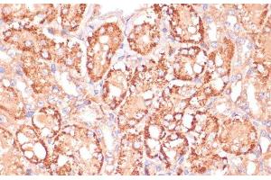 Immunohistochemistry of paraffin-embedded Mouse kidney using MAP2K3 Polyclonal Antibody at dilution of 1:100 (40x lens). (MAP2K3 anticorps)