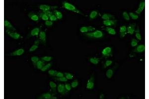Immunofluorescence staining of Hela cells with ABIN7171577 at 1:100, counter-stained with DAPI. (TAF15 anticorps  (AA 93-206))