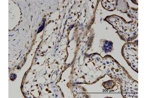 Image no. 4 for anti-Ureidopropionase, beta (UPB1) (AA 285-385) antibody (ABIN599563) (UPB1 anticorps  (AA 285-385))