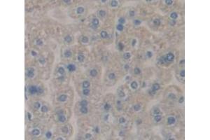 Figure. (COMT anticorps  (AA 63-265))