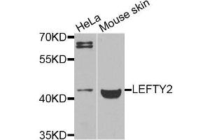 Western blot analysis of extracts of various cell lines, using LEFTY2 antibody (ABIN6003578) at 1/1000 dilution. (LEFTY2 anticorps)