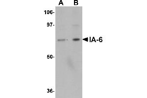 Western blot analysis of IA-6 in rat thymus tissue lysate with IA-6 antibody at (A) 1 and (B) 2 µg/mL. (INSM2 anticorps  (C-Term))