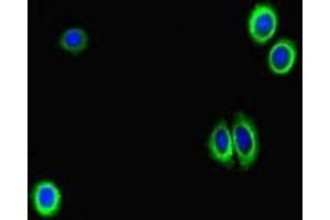 Immunofluorescent analysis of HepG2 cells using ABIN7158768 at dilution of 1:100 and Alexa Fluor 488-congugated AffiniPure Goat Anti-Rabbit IgG(H+L)