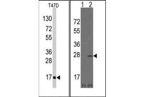 Image no. 1 for anti-Anterior Gradient Homolog 2 (Xenopus Laevis) (AGR2) (N-Term) antibody (ABIN358783) (AGR2 anticorps  (N-Term))