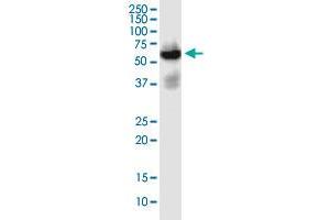 SLC22A2 monoclonal antibody (M02), clone 1E3. (SLC22A2 anticorps  (AA 261-370))