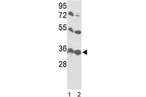 Western blot analysis of VDAC1 antibody and 1) HL-60 and 2) Y79 lysate. (VDAC1 anticorps  (AA 95-124))