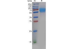 Human CRTAM Protein, His Tag on SDS-PAGE under reducing condition.
