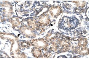 Human kidney; RGS20 antibody - middle region in Human kidney cells using Immunohistochemistry