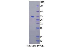 SDS-PAGE analysis of Mouse CES1 Protein. (CES1 Protéine)