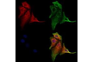 ABIN6260408 and ABIN6273204 staining Hela cells by IF/ICC. (CALCOCO2 anticorps  (Internal Region))