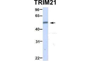 Hum. (TRIM21 anticorps  (N-Term))