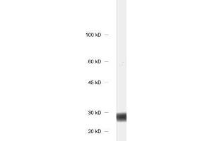dilution: 1 : 1000, sample: rat brain homogenate (CALB1 anticorps)