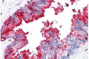 Human Prostate: Formalin-Fixed, Paraffin-Embedded (FFPE) (ADAM20 anticorps  (Internal Region))