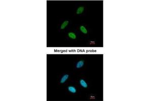 ICC/IF Image Immunofluorescence analysis of paraformaldehyde-fixed HeLa, using TAP, antibody at 1:200 dilution.