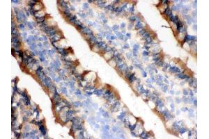 IHC analysis of IDH1 using anti-IDH1 antibody .
