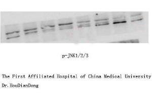 Western Blot (WB) analysis: Please contact us for more details. (JNK anticorps  (pThr183, pTyr185))