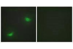 Immunofluorescence analysis of HepG2 cells, using DUSP16 antibody.