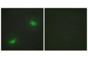 Immunofluorescence analysis of HepG2 cells, using DUSP16 antibody. (DUSP16 anticorps)