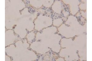 Detection of TM in Rat Lung Tissue using Polyclonal Antibody to Thrombomodulin (TM) (Thrombomodulin anticorps  (AA 324-480))