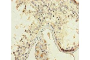 Immunohistochemistry of paraffin-embedded human testis tissue using ABIN7155217 at dilution of 1:100 (HMGB4 anticorps  (AA 1-186))