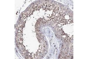 Immunohistochemical staining of human testis with PUS3 polyclonal antibody  shows moderate cytoplasmic positivity in cells in seminiferus ducts at 1:50-1:200 dilution. (PUS3 anticorps)