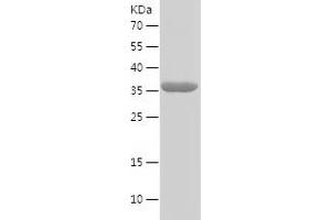 Western Blotting (WB) image for Melanin-Concentrating Hormone Receptor 1 (MCHR1) (AA 1-105) protein (His-IF2DI Tag) (ABIN7123881)