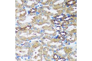 Immunohistochemistry of paraffin-embedded Mouse kidney using FBXO21 Rabbit pAb (ABIN7267085) at dilution of 1:100 (40x lens). (FBXO21 anticorps  (AA 440-621))