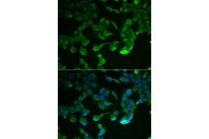 Immunofluorescence analysis of HeLa cells using C1R antibody (ABIN5973769). (C1R anticorps)