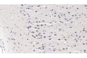 Detection of PSME3 in Human Cerebrum Tissue using Polyclonal Antibody to Proteasome Activator Subunit 3 (PSME3)
