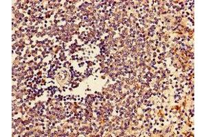 Immunohistochemistry of paraffin-embedded human spleen tissue using ABIN7147027 at dilution of 1:100