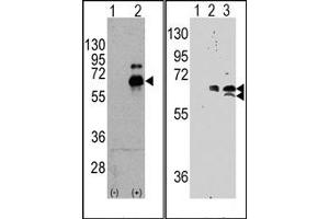 Image no. 2 for anti-Ribosomal Protein S6 Kinase, 70kDa, Polypeptide 1 (RPS6KB1) (Ser424) antibody (ABIN5552136) (RPS6KB1 anticorps  (Ser424))