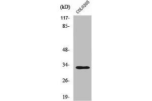 Western Blot analysis of COLO205 cells using UBCE7IP4 Polyclonal Antibody (RNF144A anticorps  (Internal Region))