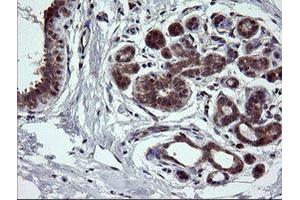 Image no. 3 for anti-NIMA (Never In Mitosis Gene A)-Related Kinase 11 (NEK11) antibody (ABIN1499682)