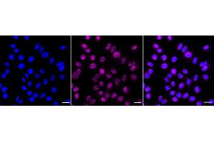 Immunocytochemical staining of HepG2 cells with PCBD1 antibody (ABIN7800060), 1:1,000).