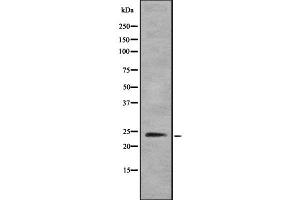 Western blot analysis of TPPP using HeLa whole  lysates. (Tppp anticorps  (N-Term))