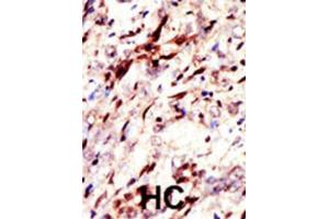 Immunohistochemistry (IHC) image for anti-Pan SUMO (SUMO (pan)) (pan) antibody (ABIN2997018) (Pan SUMO (SUMO (pan)) (pan) anticorps)