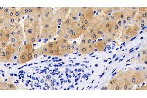 Detection of CASP8 in Human Liver Tissue using Polyclonal Antibody to Caspase 8 (CASP8)