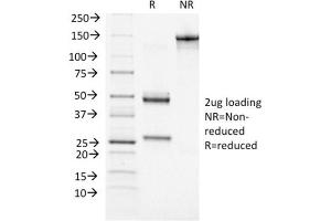 SDS-PAGE Analysis Purified BRCA1 Mouse Monoclonal Antibody (BRCA1/1472). (BRCA1 anticorps  (AA 445-620))