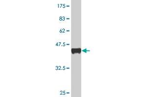 Western Blot detection against Immunogen (36. (CBL anticorps  (AA 736-835))