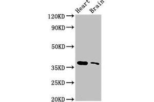 Western Blot Positive WB detected in: Mouse heart tissue, Mouse brain tissue All lanes: SRR antibody at 3 μg/mL Secondary Goat polyclonal to rabbit IgG at 1/50000 dilution Predicted band size: 37 kDa Observed band size: 37 kDa (SRR anticorps  (AA 1-340))