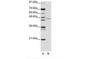Image no. 1 for anti-Tripartite Motif Containing 14 (TRIM14) (AA 116-165) antibody (ABIN203143) (TRIM14 anticorps  (AA 116-165))
