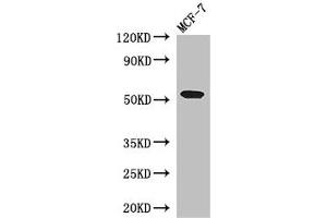Western Blot Positive WB detected in: MCF-7 whole cell lysate All lanes: PSEN1 antibody at 3 μg/mL Secondary Goat polyclonal to rabbit IgG at 1/50000 dilution Predicted band size: 53, 43, 22, 47, 49 kDa Observed band size: 53 kDa (Presenilin 1 anticorps  (AA 4-218))