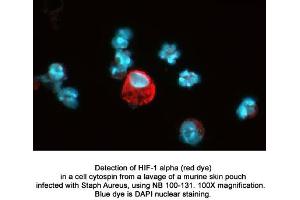 Image no. 5 for anti-Hypoxia Inducible Factor 1, alpha Subunit (Basic Helix-Loop-Helix Transcription Factor) (HIF1A) (AA 329-530) antibody (ABIN363210)