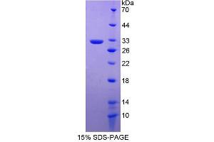 Image no. 1 for Regulator of G-Protein Signalling 19 (RGS19) (AA 1-217) protein (His tag) (ABIN6237853)