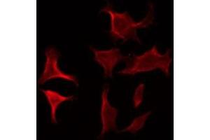 ABIN6275926 staining COLO205 by IF/ICC. (CRHR2 anticorps  (Internal Region))