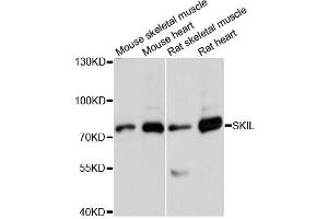 Western blot analysis of extracts of various cell lines, using SKIL antibody (ABIN6292273) at 1:3000 dilution. (SKIL anticorps)