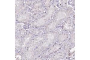 Immunohistochemical staining of human kidney with C10orf35 polyclonal antibody  shows distinct membranous positivity in subsets of glomerular cells at 1:500-1:1000 dilution. (C10ORF35 anticorps)