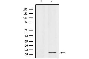 anti-Ribosomal Protein L36 (RPL36) (C-Term) antibody