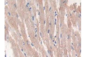 Detection of CS in Rat Heart Tissue using Polyclonal Antibody to Citrate Synthase (CS)